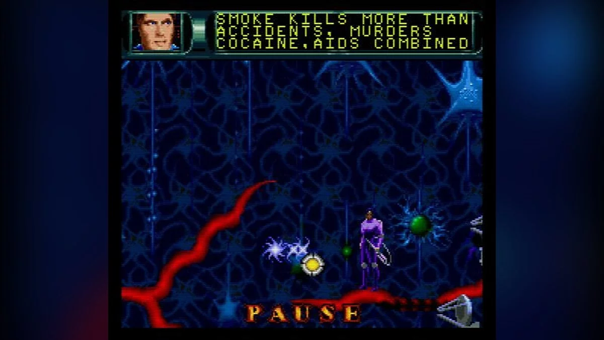 Скриншот из игры Rex Ronan: Experimental Surgeon - 5