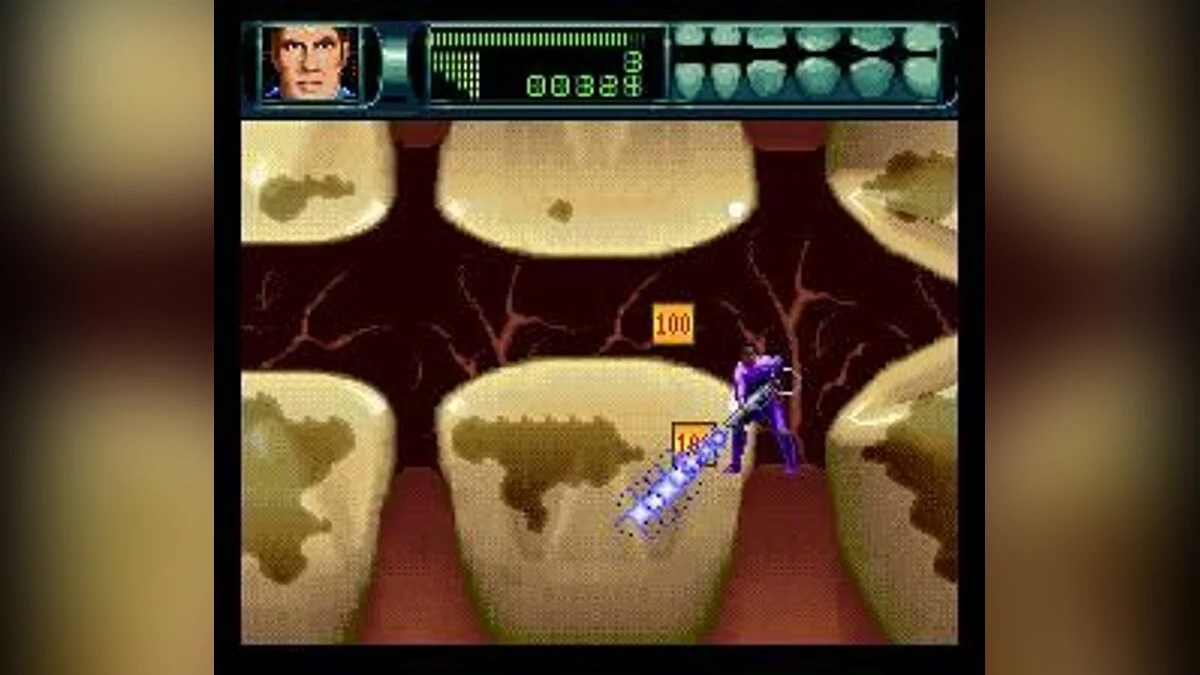 Скриншот из игры Rex Ronan: Experimental Surgeon - 6