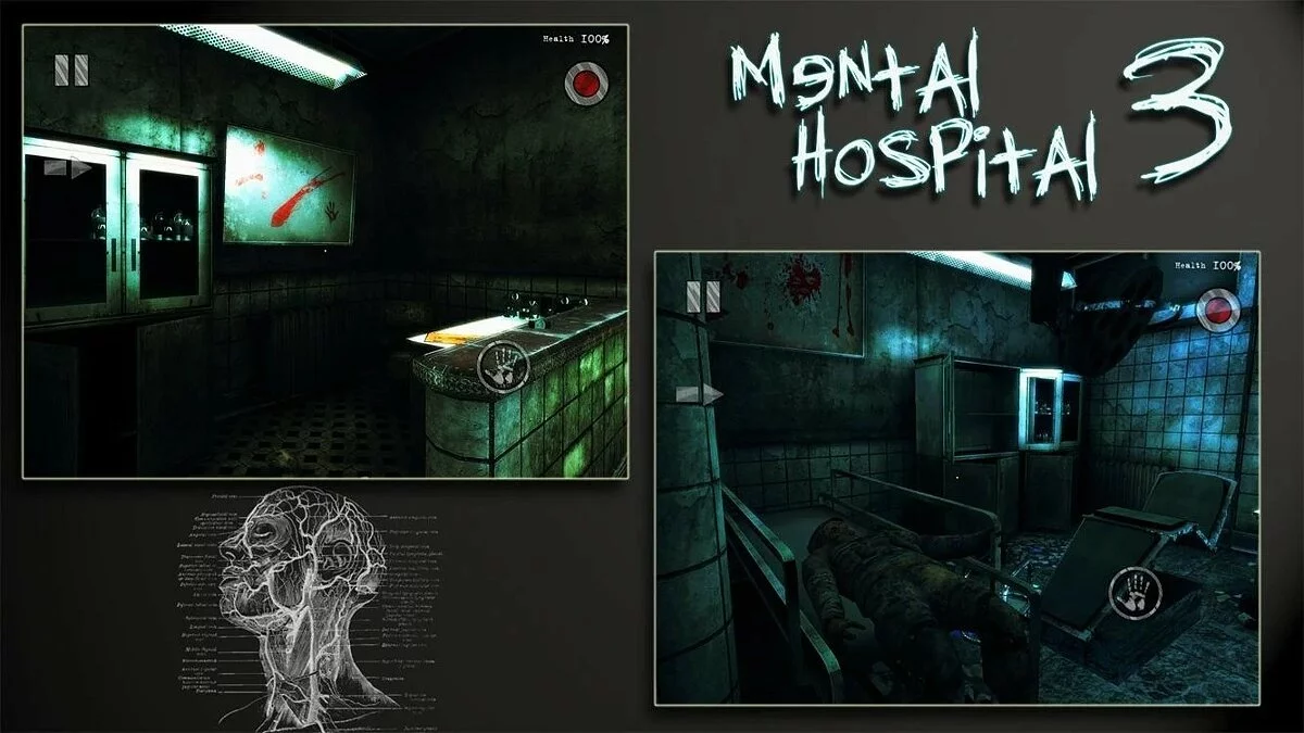 Скриншот из игры Mental Hospital 3 - 10