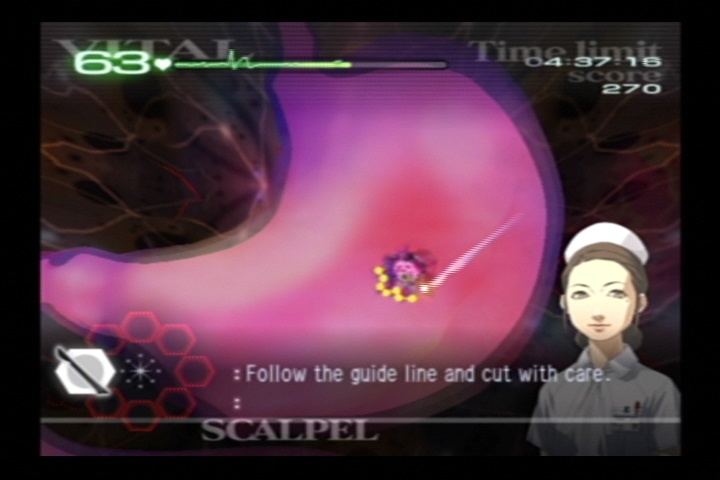 Скриншот из игры Trauma Center: Second Opinion - 38