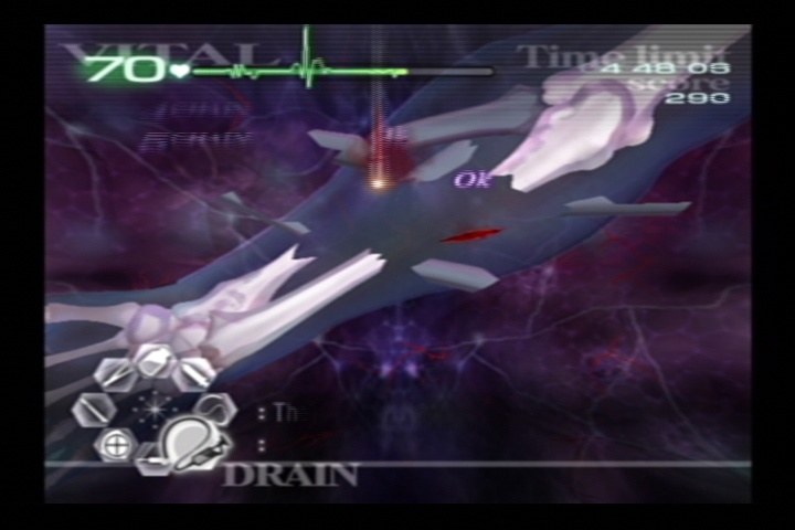 Скриншот из игры Trauma Center: Second Opinion - 16