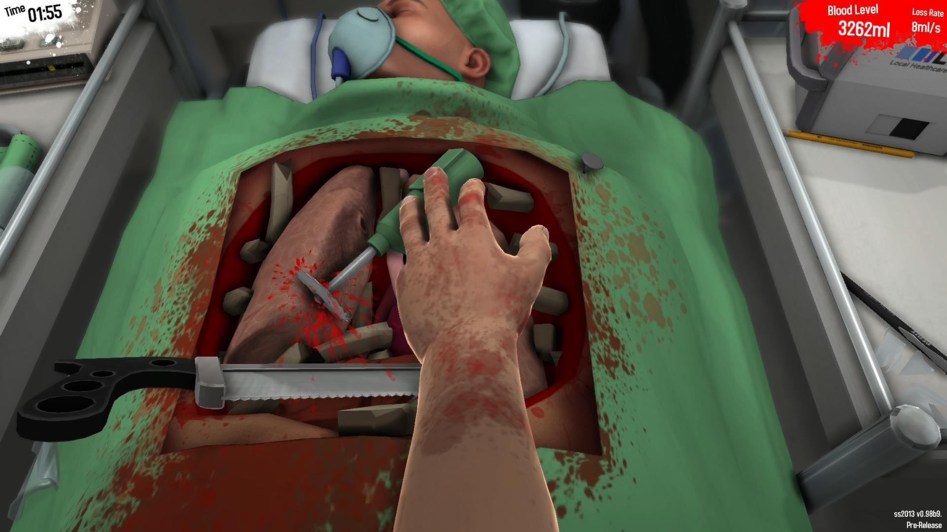 Скриншот из игры Surgeon Simulator - 62