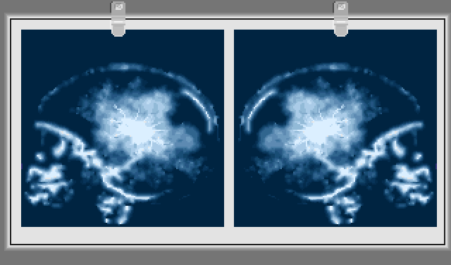 Скриншот из игры Life & Death 2: The Brain - 12